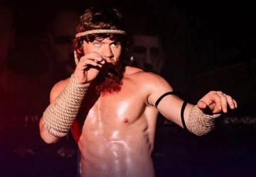 Shara Magomedov Ungkap Derita Patah Hidung, 3 Minggu Baru Bisa Bernapas Normal