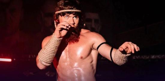 Shara Magomedov Ungkap Derita Patah Hidung, 3 Minggu Baru Bisa Bernapas Normal