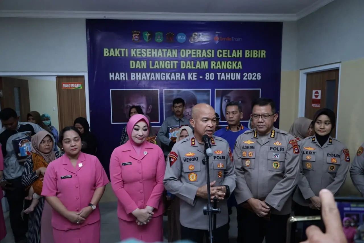 Sambut HUT Bhayangkara ke-80, Polda Banten Wujudkan Harapan 25 Anak Melalui Operasi Bibir Sumbing